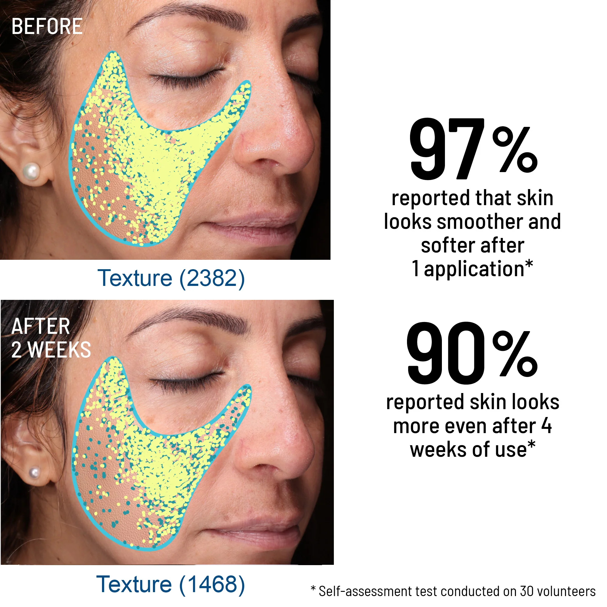 Advanced Microdermabrasion Face Exfoliator - Image 6