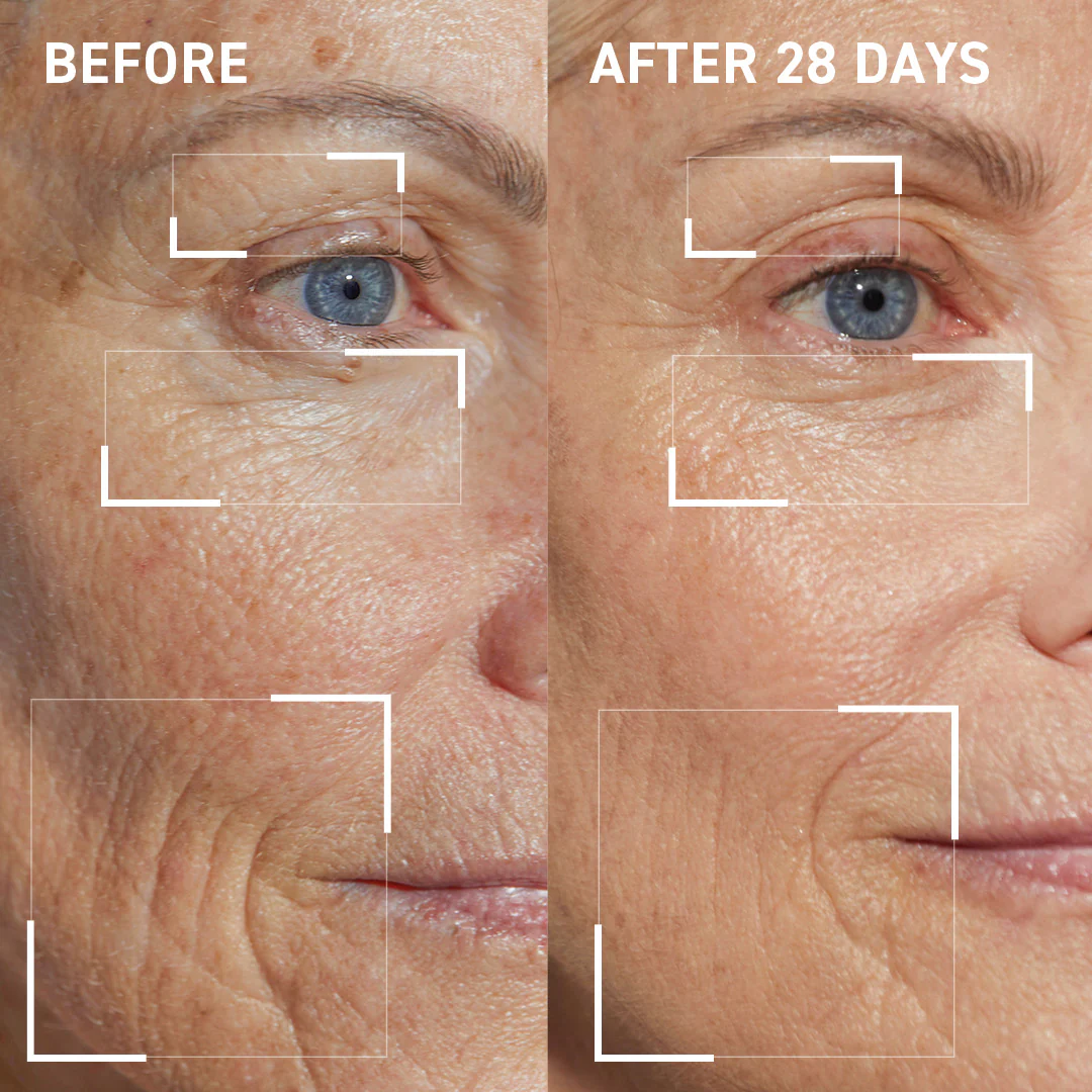 Collagen Support Kit - Image 4