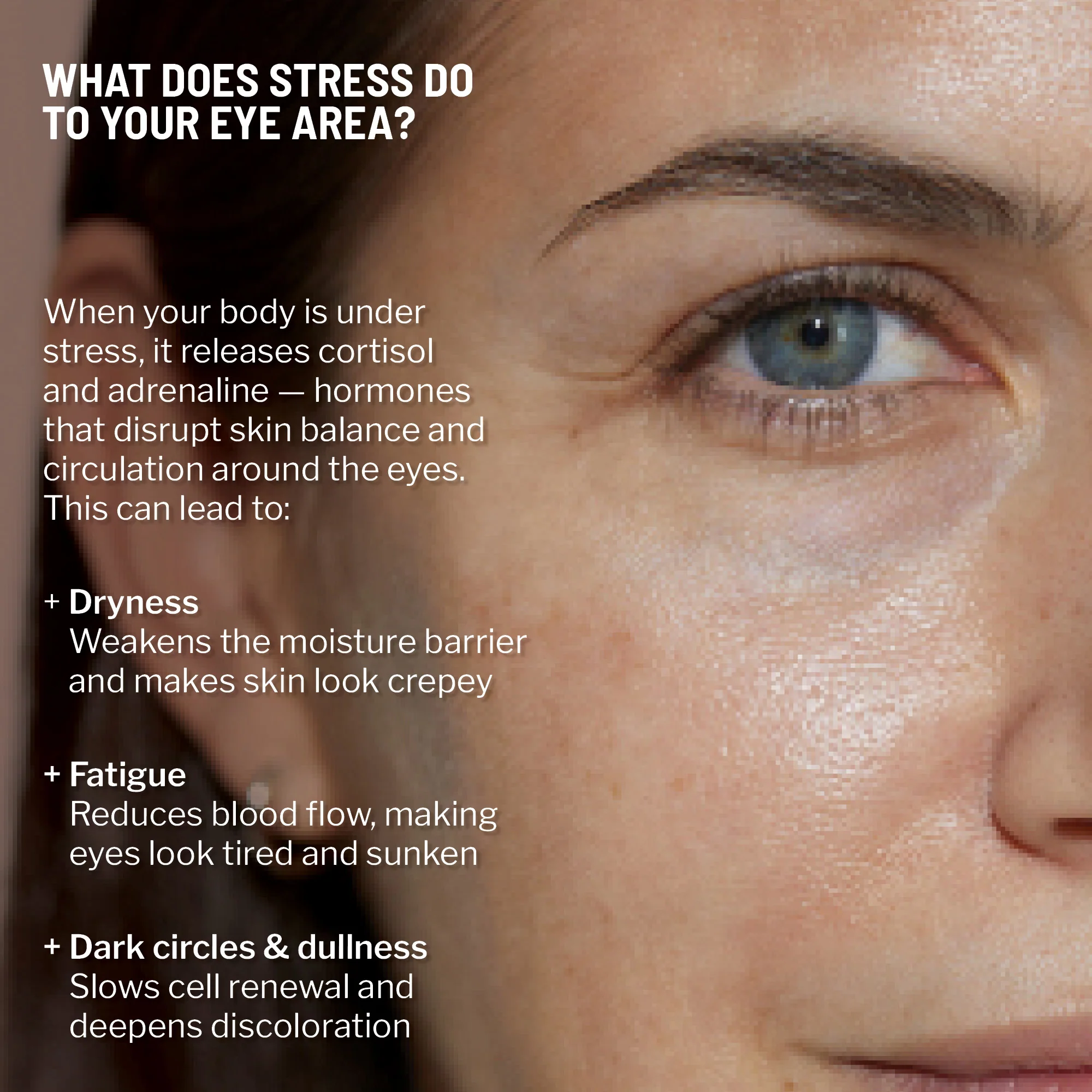 Eye Puffiness & Fatigue Duo - Image 3