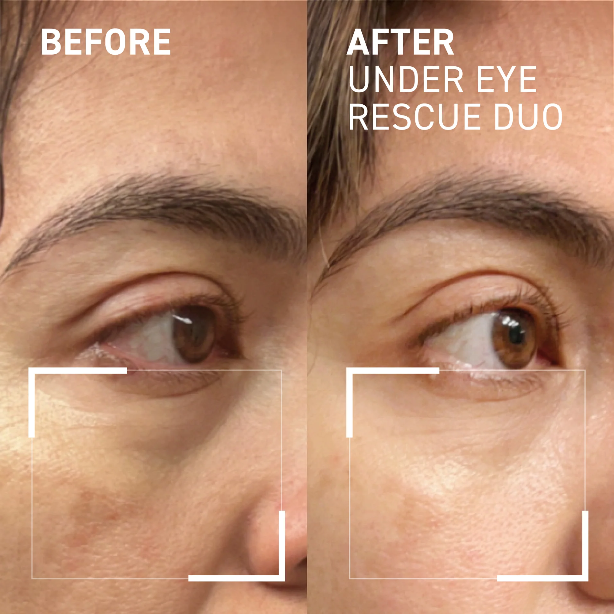 Eye Puffiness & Fatigue Duo - Image 6
