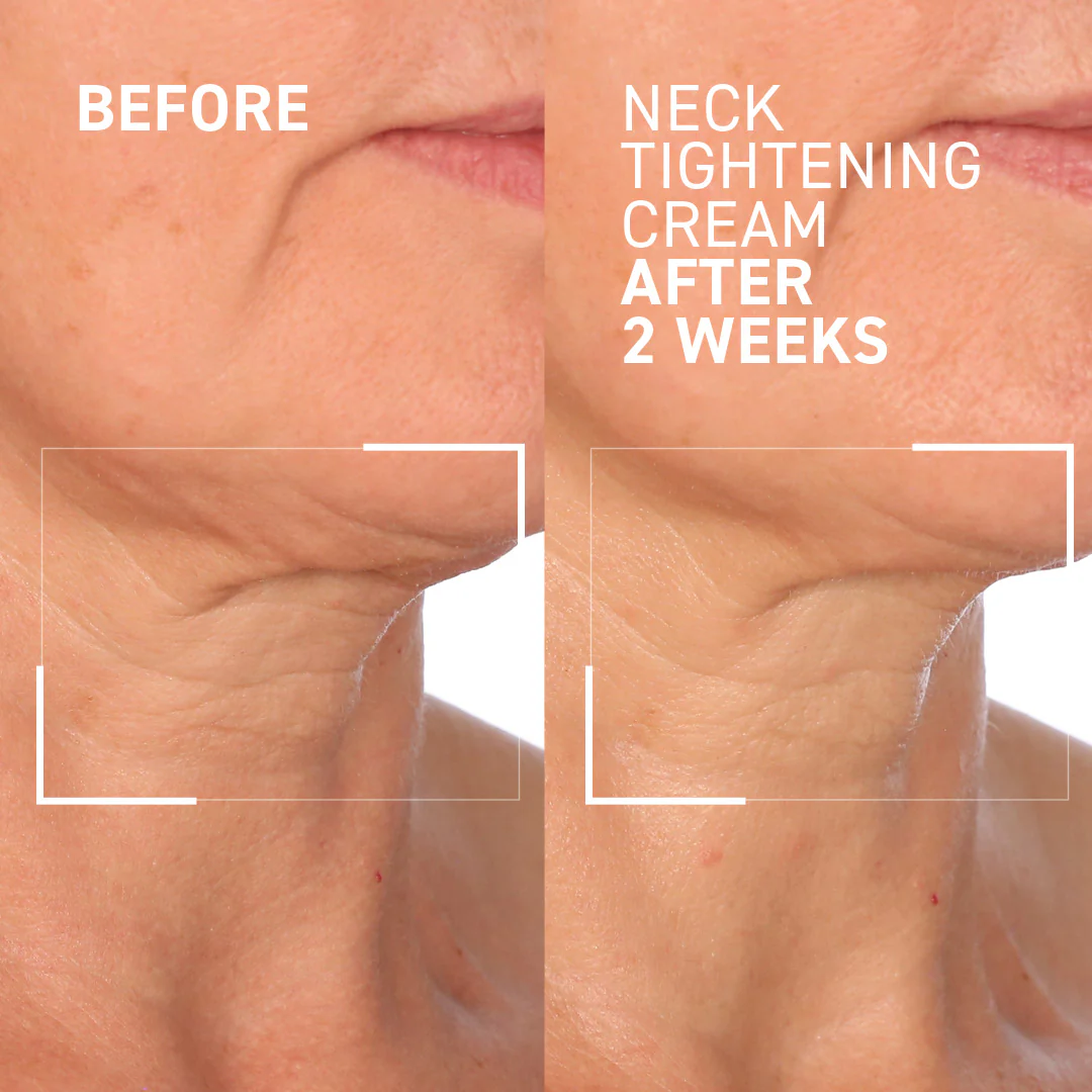 Face & Neck Lifting Duo - Image 4