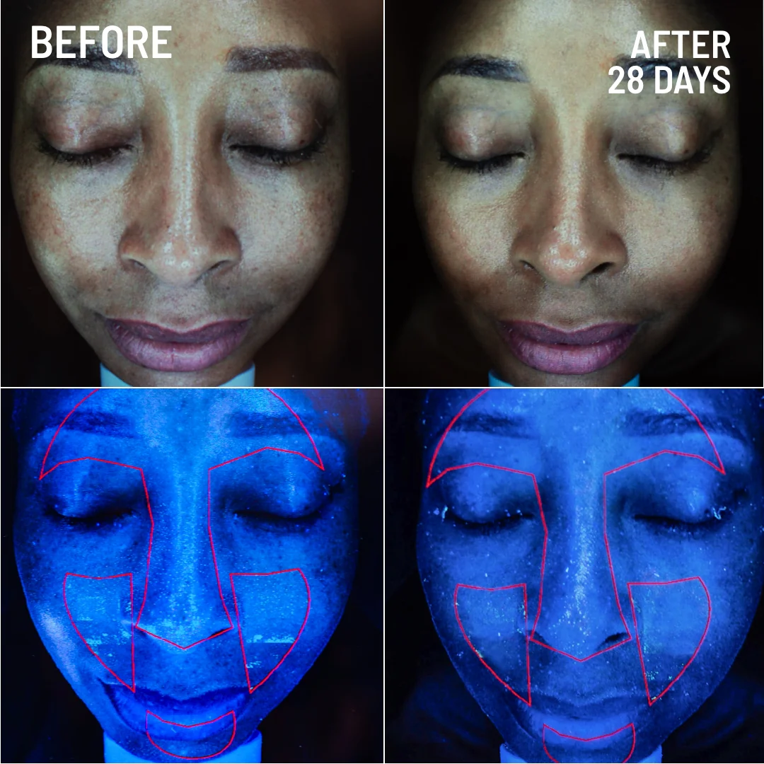 Gentle Microdermabrasion Face Exfoliator - Image 6