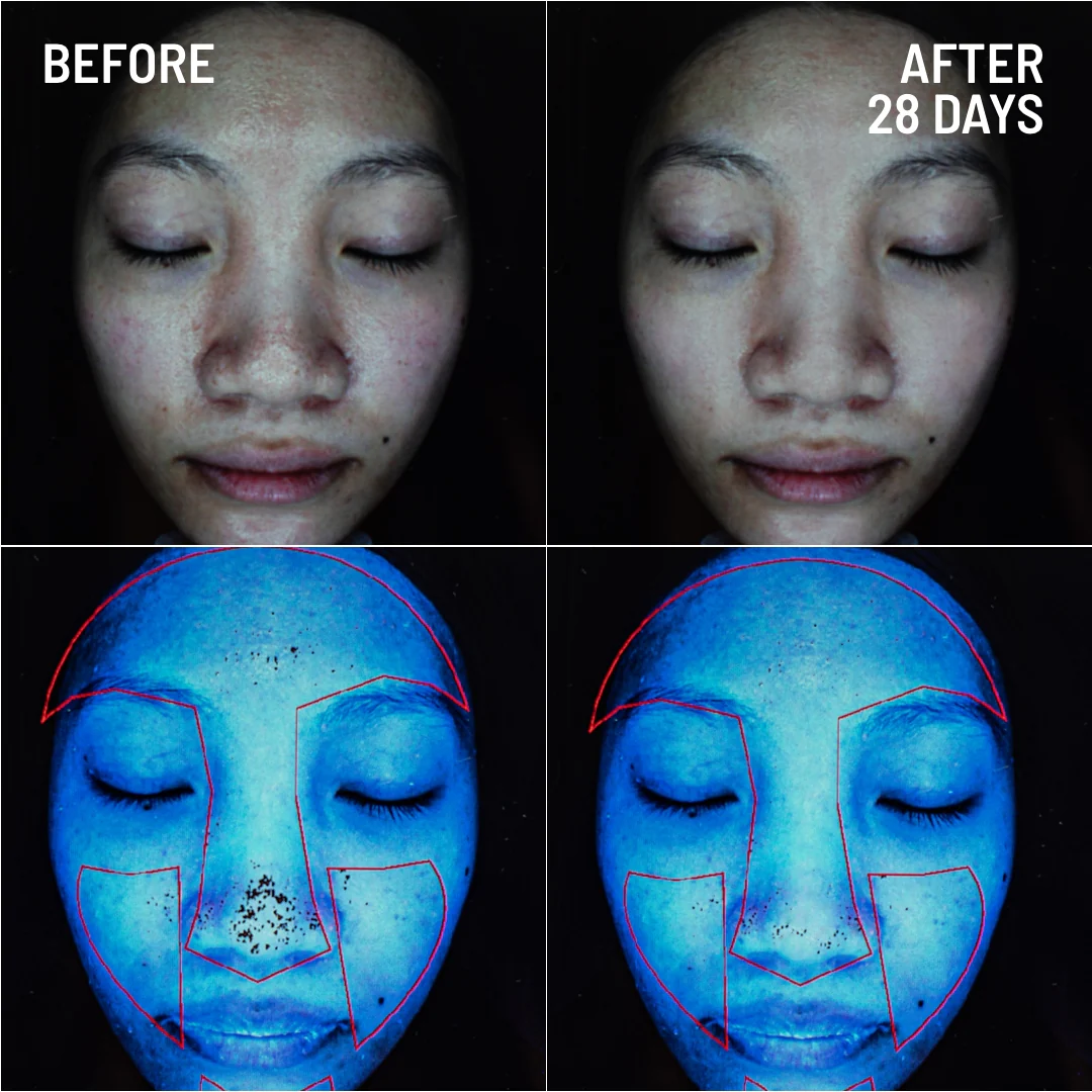 Gentle Microdermabrasion Face Exfoliator - Image 8