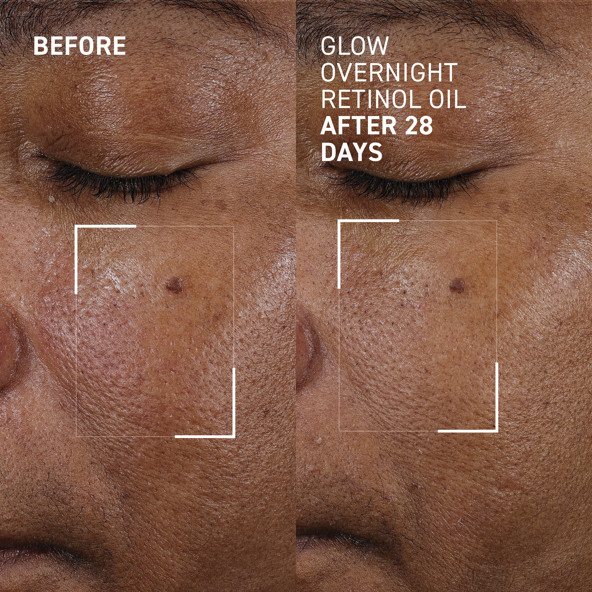 Glow Overnight Retinol Oil - Image 3