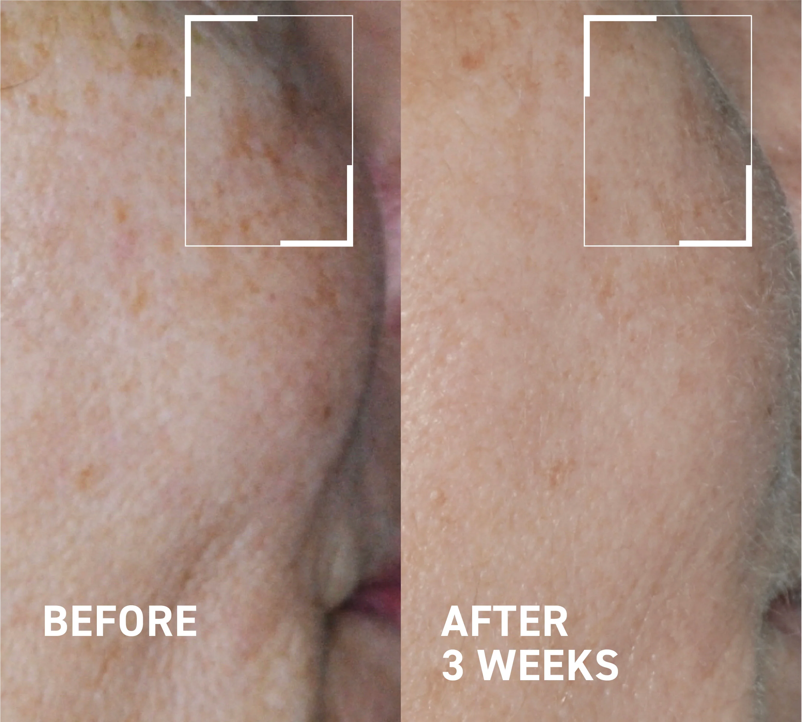 Hyperpigmentation & Melasma Routine - Image 4