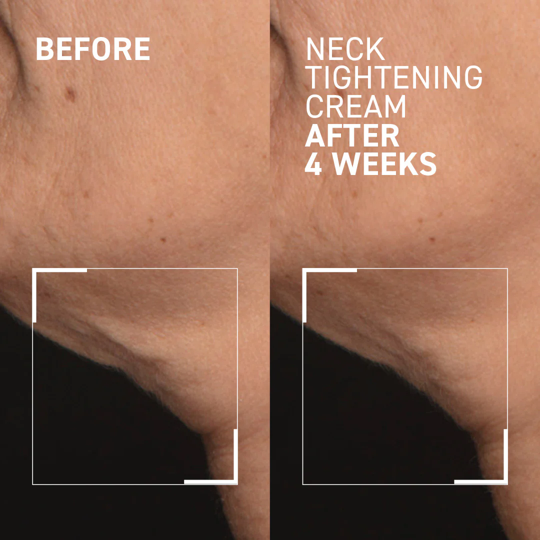 Neck Tightening Cream + GUA SHA - Image 3