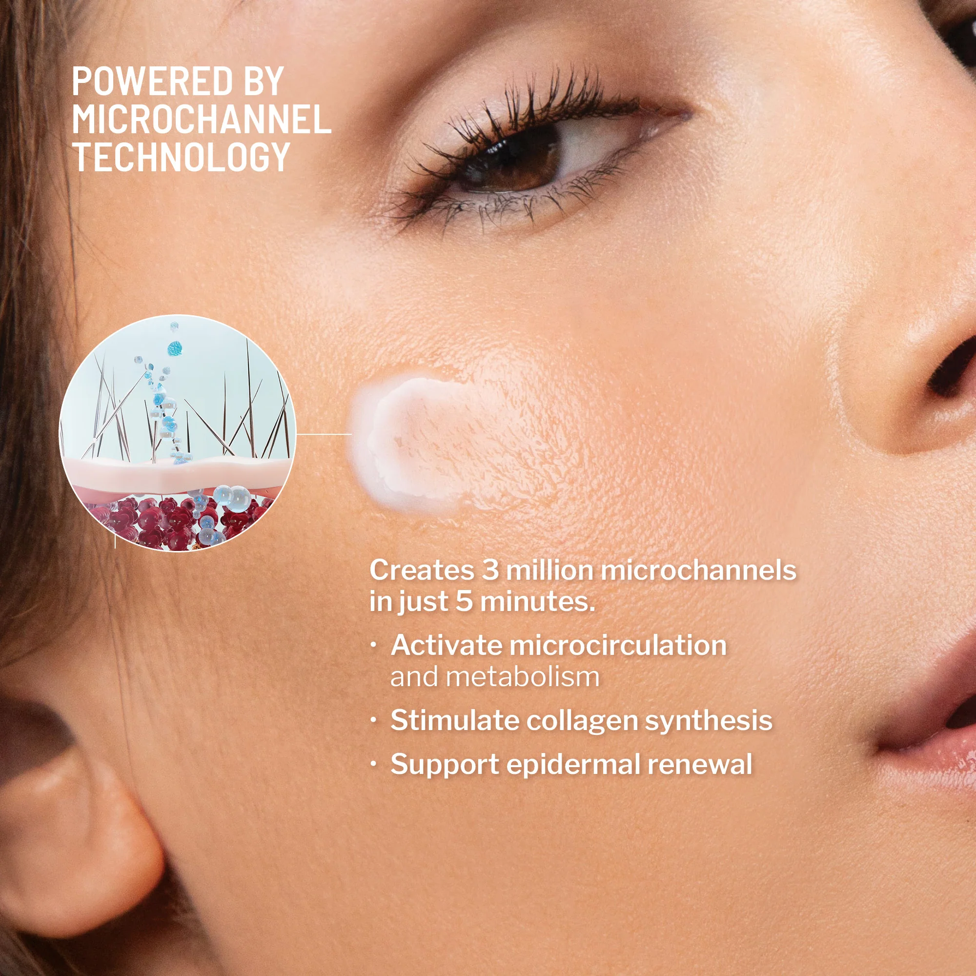 Dermal Micro Points - Image 5