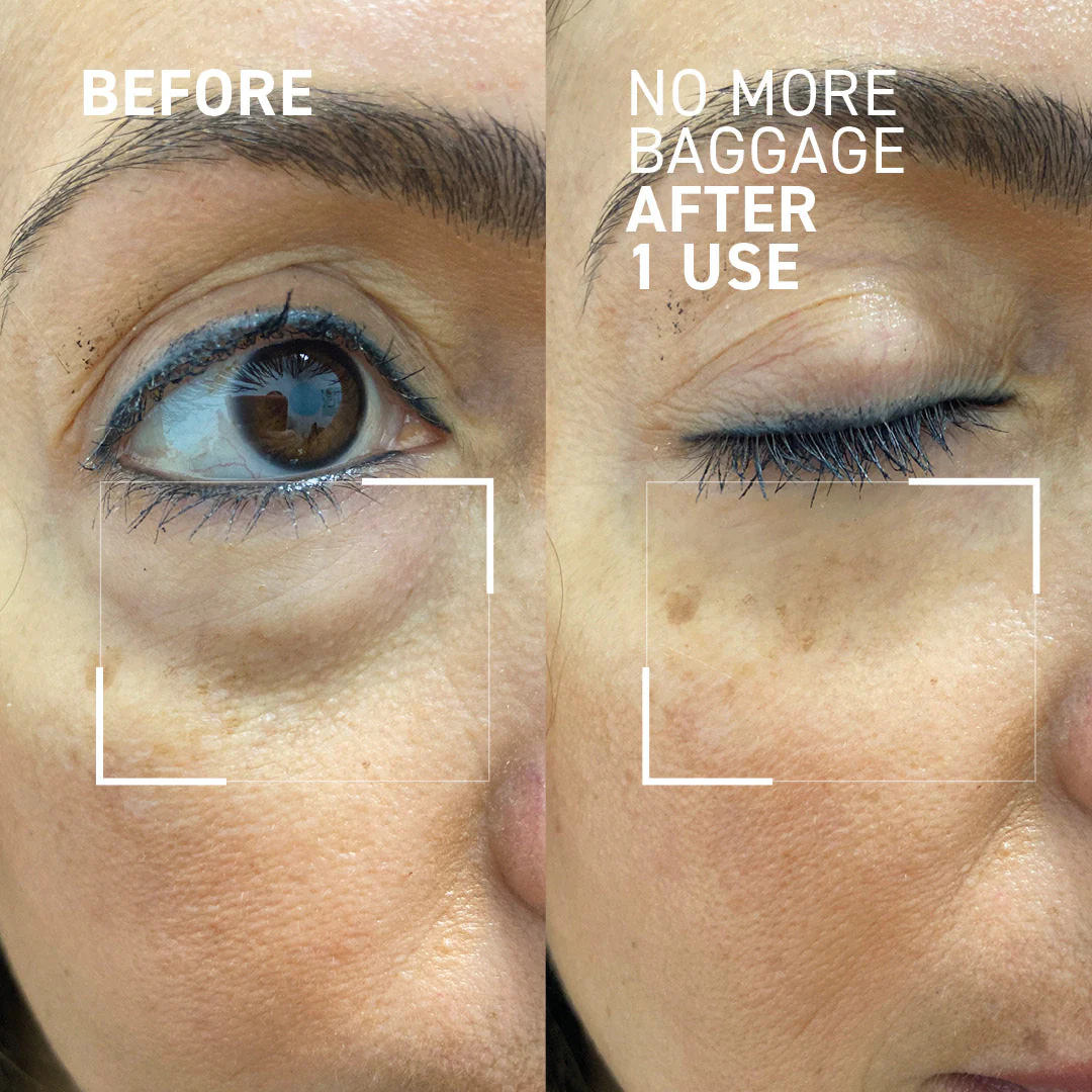 Depuffing & Pore Refining Duo - Image 7