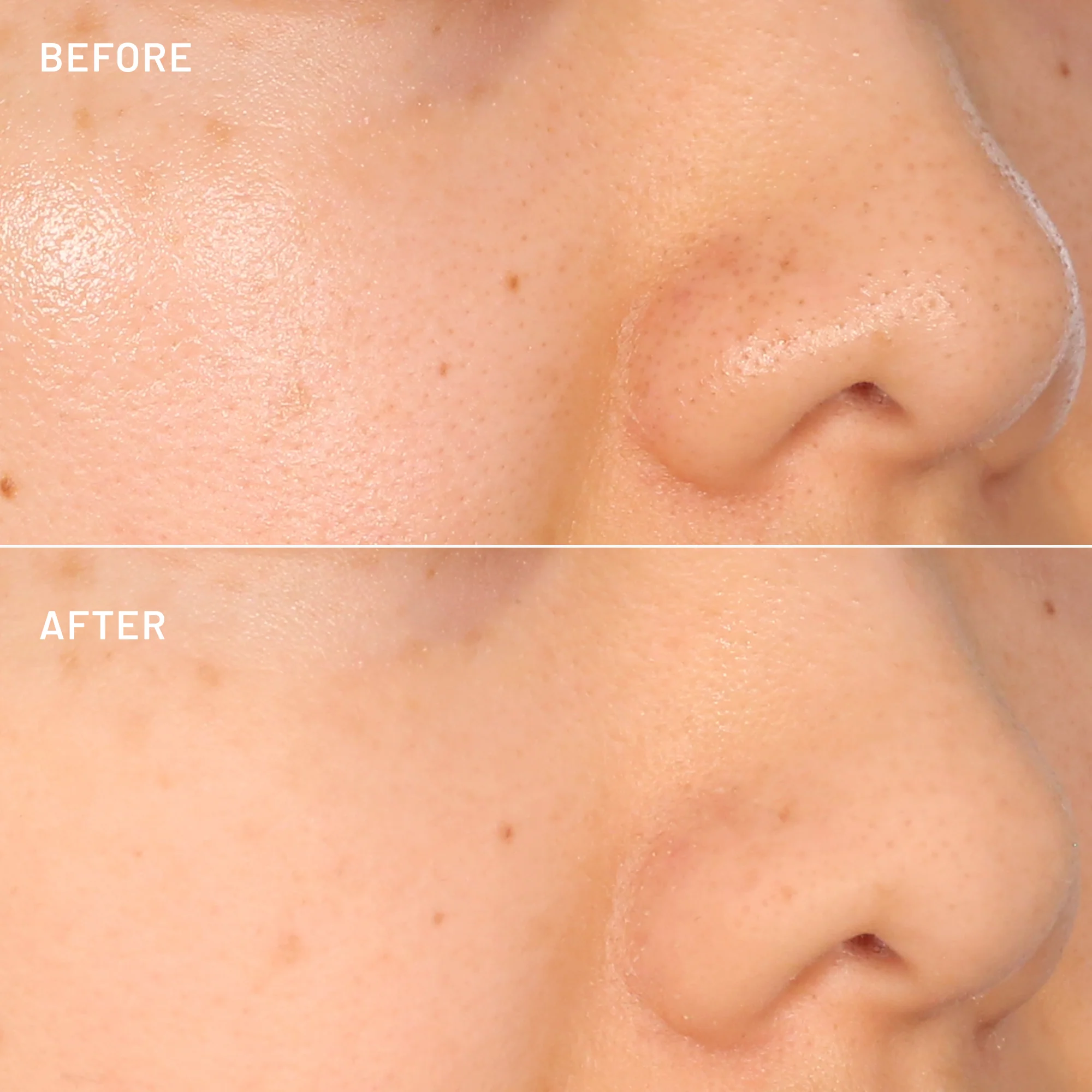 The Pore-Fect Set - Image 5