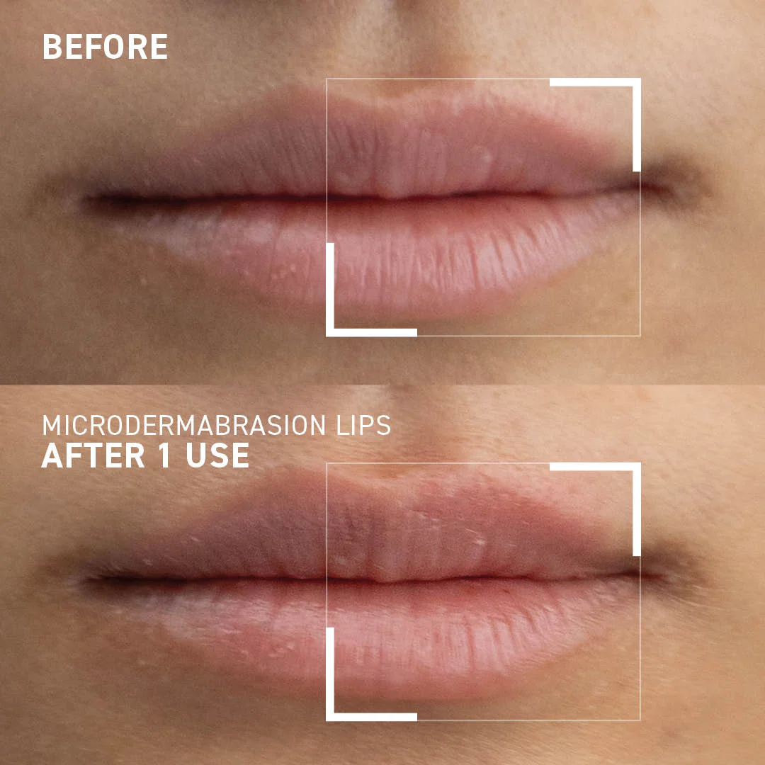 Smoothing Lip Exfoliator - Image 6